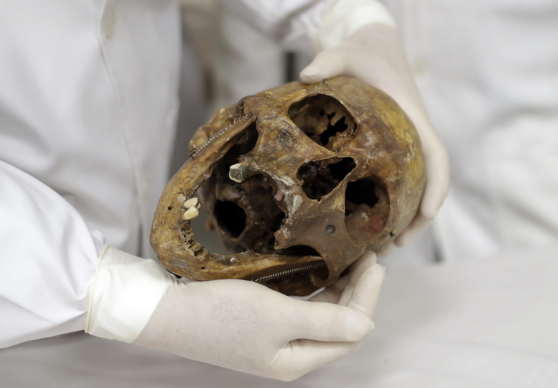 Los huesos del nazi Mengele, utilizados para estudiar medicina forense en Brasil