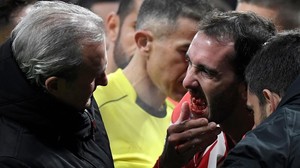 Godín le muestra al doctor del Atlético su boca donde le faltan los tres dientes que acaba de perder en un encontronazo con el meta valencianista Neto.